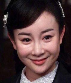明星面部表情僵硬